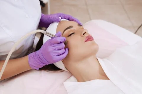 Procedure of Microdermabrasion. Stock Photos
