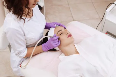 Procedure of Microdermabrasion. Foto stock