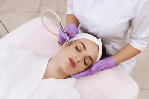 Procedure of Microdermabrasion. Stock Photos