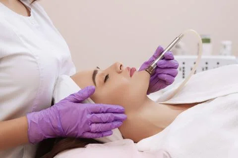 Procedure of Microdermabrasion. Stock Photos