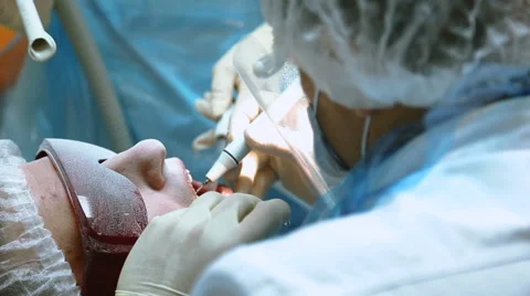 Procedure of professional teeth cleaning Stock Footage 67559603