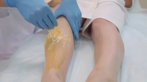 The procedure shugaring Stock Footage 83232610