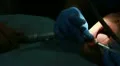 Procedure of teeth polishing HD Footage