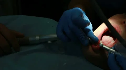 Procedure of teeth polishing Stock Footage 10718249