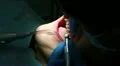 Procedure of teeth polishing HD Footage