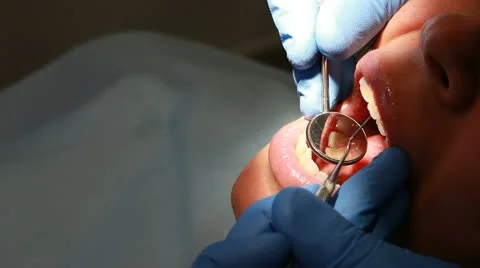 Procedure of teeth total control Stock Footage 10767274