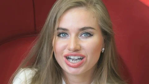 Procedure of teeth whitening Stock Footage 72340980