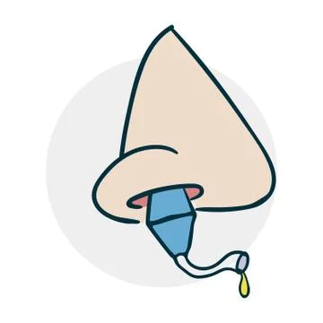 Procedure for the treatment of sinusitis Stock Illustration