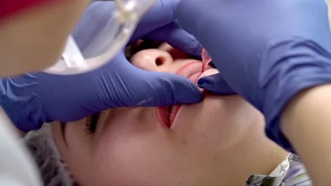 Process of applying permanent makeup tattoo of red on lips woman in beautician Stock Footage 169110916