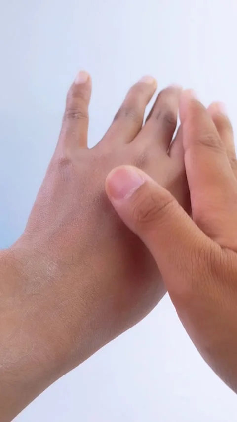 Process of applying whitening cream on left hand, then showing the difference Vídeo Stock 335388697