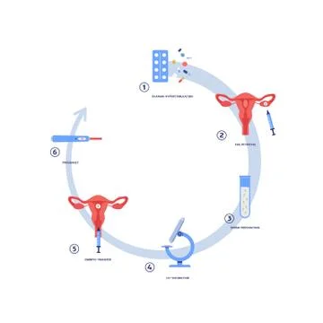 Process of artificial fertilization, flat vector illustration isolated. Illustrazione stock