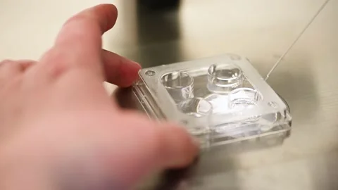 Process of artificial insemination of an egg in an IVF clinic. Reproductive Stock-Footage 170199240