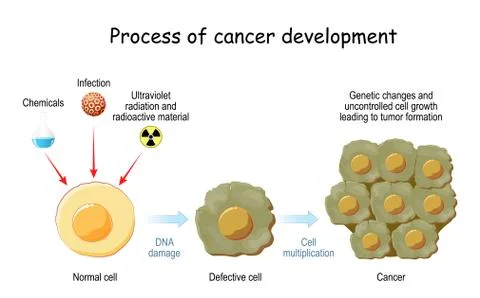 Process of cancer cell development. Stock Illustration
