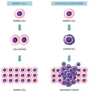 Process of cancer cell development Illustrazione stock