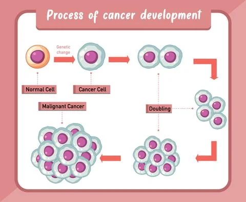 Process of cancer development infographic Stock Illustration