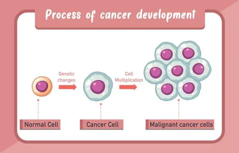 Process of cancer development infographic Stock Illustration