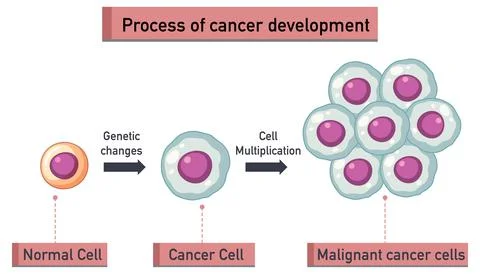 Process of cancer development infographic Stock Illustration