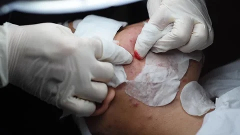 The process of cleaning the face. Stock Footage 140152427