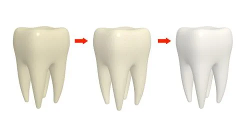 Process of cleaning teeth Stock Illustration