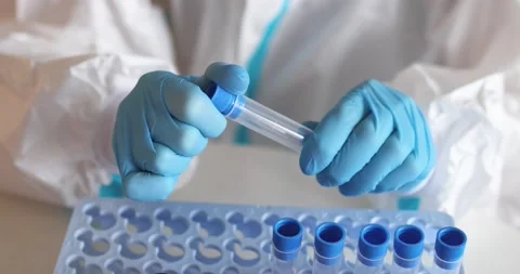 Process of coronavirus PCR antigen testing, COVID-19 swab collection kit test Vídeos de archivo 171162159