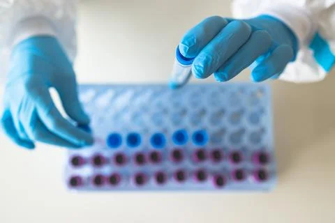 Process of coronavirus PCR antigen testing examination by nurse medic in labo Foto stock