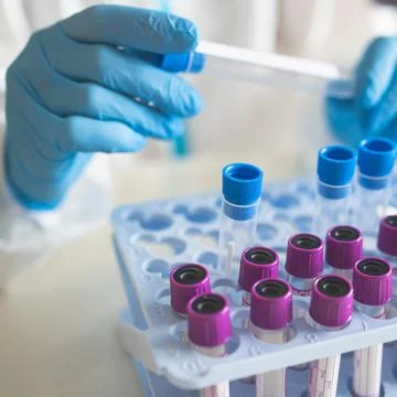 Process of coronavirus PCR antigen testing examination by nurse medic in labo Foto stock