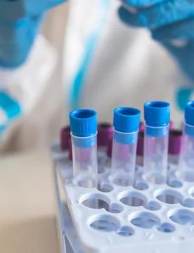 Process of coronavirus PCR antigen testing examination by nurse medic in labo Stock Photos