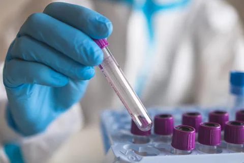 Process of coronavirus PCR antigen testing examination by nurse medic in labo Foto stock