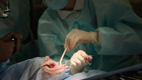The process of dental surgery. Stock Footage 236053019