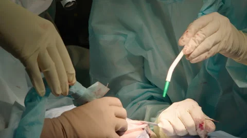 The process of dental surgery. Stock Footage 236053039