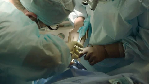 The process of dental surgery. Stock Footage 236054771