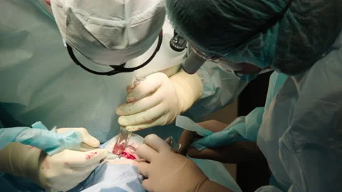 The process of dental surgery. Stock Footage 236055205