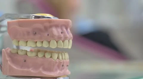 The Process of Dental Work Stock Footage 69001827