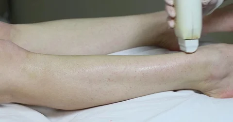 Process depilation female legs and hands Stock Footage 72828489