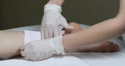 Process depilation female legs and hands Stock Footage 72828733