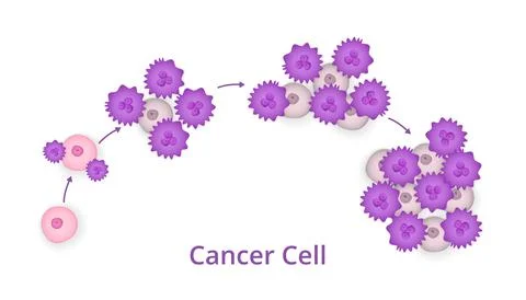 Process of development of cancer cells Stock Illustration