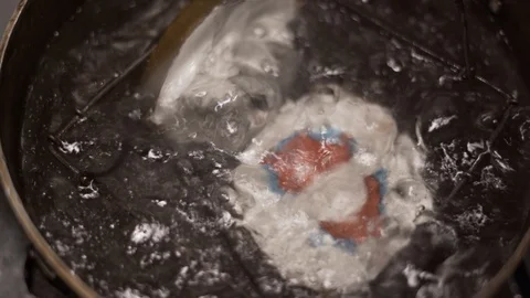 The process of dewaxing og RPD, also boiling the artificial jaw in hot Stock Footage 108007403