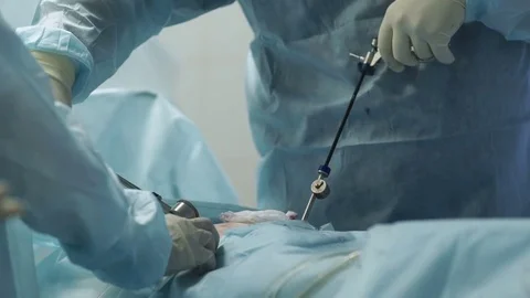 Process difficult surgery on the uterus 库存影片 72977798