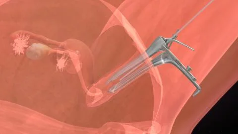 Process of embryo transfer Stock Illustration