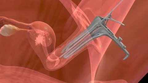 Process of embryo transfer Stock Illustration
