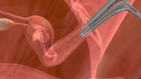 Process of embryo transfer Illustrazione stock