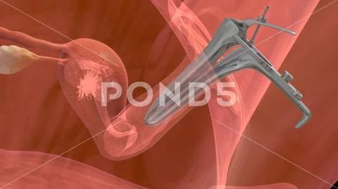 Process of embryo transfer: Royalty Free #77615514