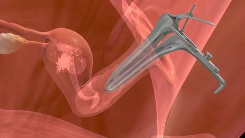 Process of embryo transfer Stock Illustration