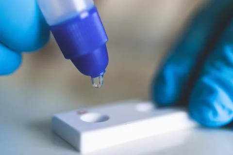 Process of express fast coronavirus covid Antigen AG PCR testing examination  Фото