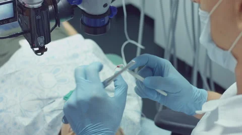 Process of filling the sick tooth of the patient using modern dental equipment Stock Footage 68080208