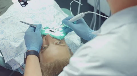 Process of filling the sick tooth of the patient using modern dental equipment Stock Footage 68080422