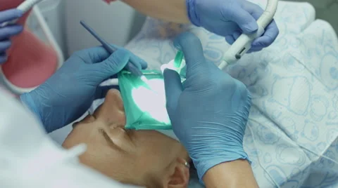 Process of filling the sick tooth of the patient using modern dental equipment Stock Footage 68080454