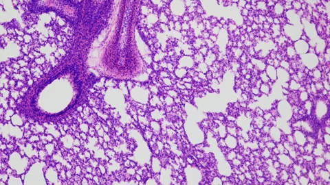 The process of gas exchange in the human lungs. Light tissue section under Stock Footage 252810028