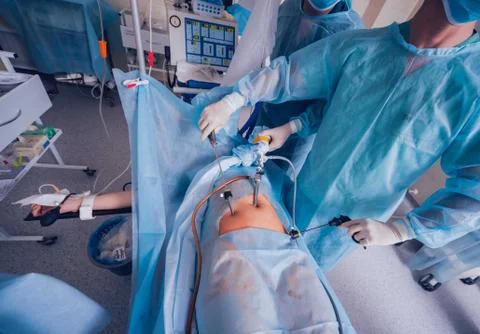 Process of gynecological surgery operation using laparoscopic equipment. Stock Photos
