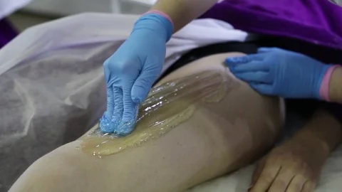 Process of hair removal with shugaring Stock Footage 82960109